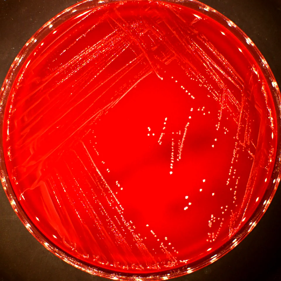 Blood agar plate with small white bacterial colonies along streak lines