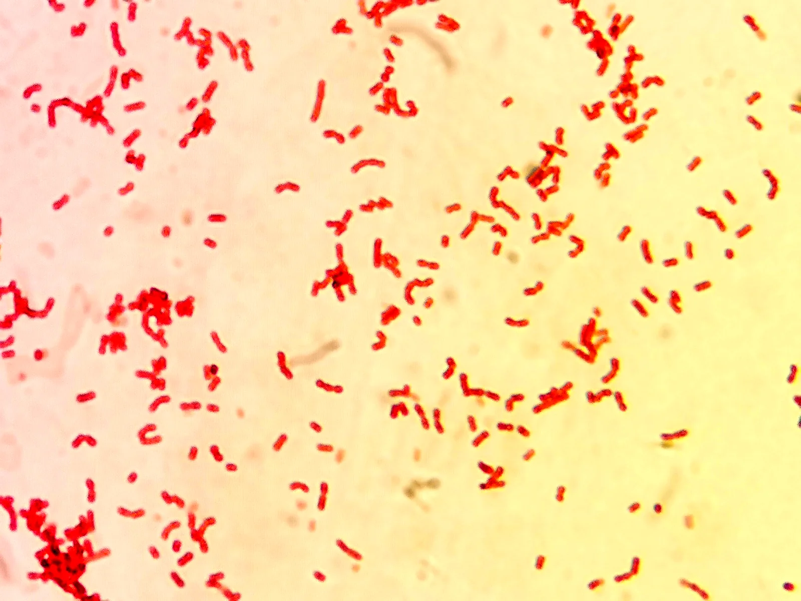 Gram stain showing pink Gram-negative rods under the microscope